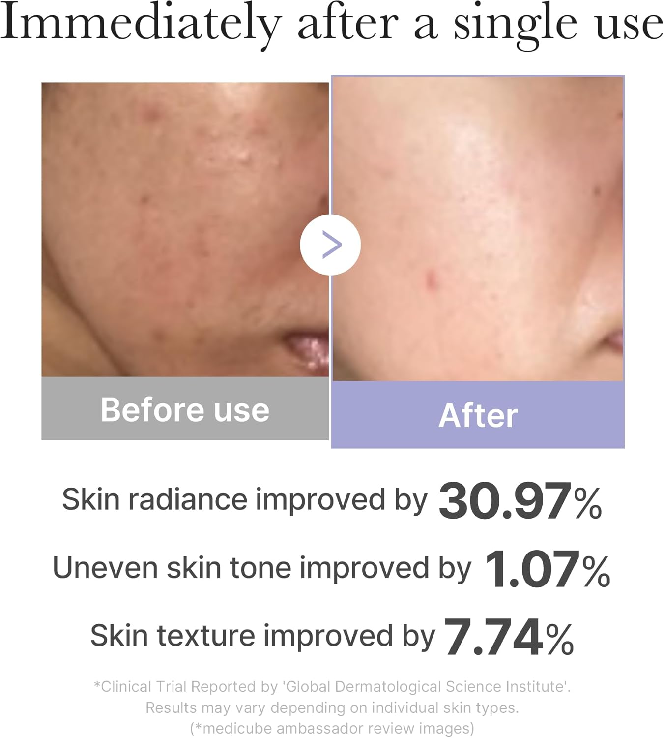 AGE-R Booster Mini - Medicube