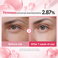 Medicube PDRN Pink Peptide Eye Cream – 30ml